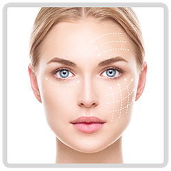 SLU - MONO COLLAGEN THREAD