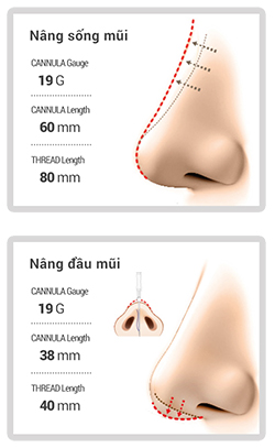 SLU - NOSE THREAD
