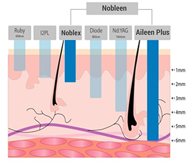 nobleen - máy laser han quốc